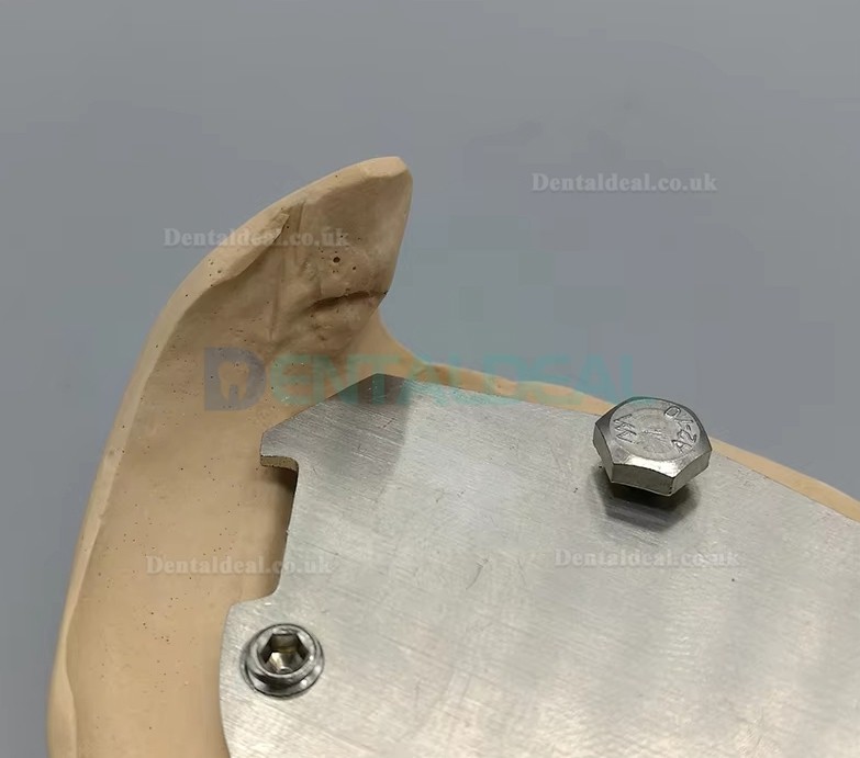 Dental Gothic Arch Tracer for Vertical Centric Recording